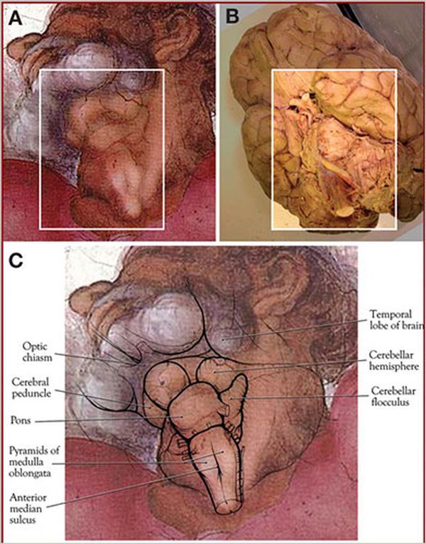 редкое анатомическое изображение кисти Микеланджело